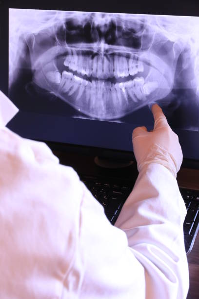Best Emergency Tooth Extraction in Groesbeck, OH