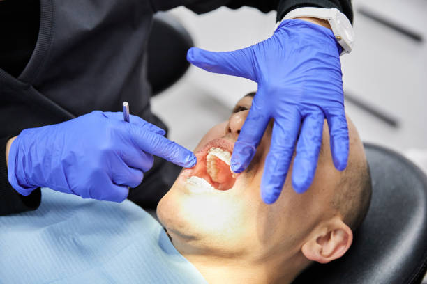 Best Walk-In Emergency Dentist in Groesbeck, OH